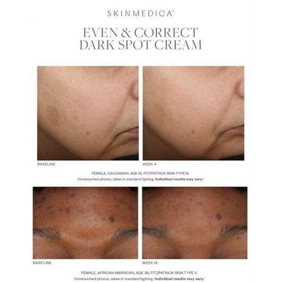 SkinMedica Even & Correct Dark Spot Cream Discoloration Brightening Antiaging - Picture 4 of 11